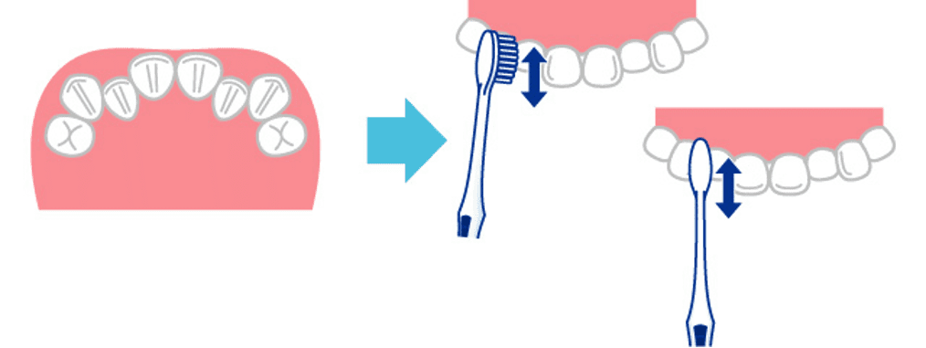 歯並びが不揃いなところは1本1本にハブラシの当てる角度を変えながら毛先を上下に細かく動かす:画像