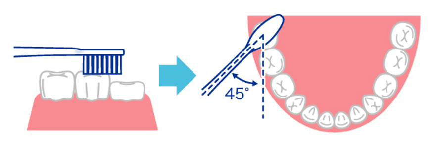 奥歯の背の低い歯に対しては、ハブラシを斜めから入れて細かく動かす:画像