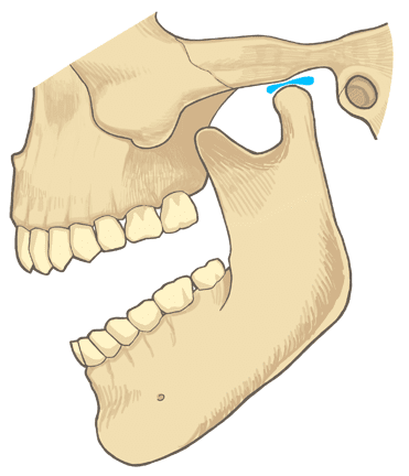 顎関節症の3大症状